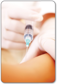 Ischial bursitis corticosteroid injection